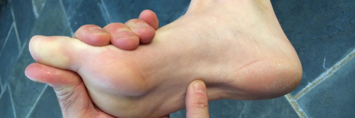 Fascitis plantar que no se cura: ¿estás tratando el síntoma o la causa real?