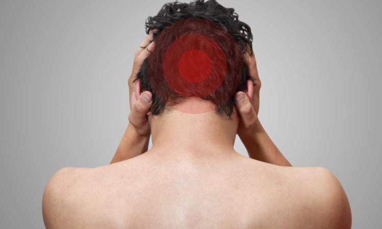 Dolor en la parte superior del cráneo: por qué la coronilla duele y cómo tratarla desde la raíz